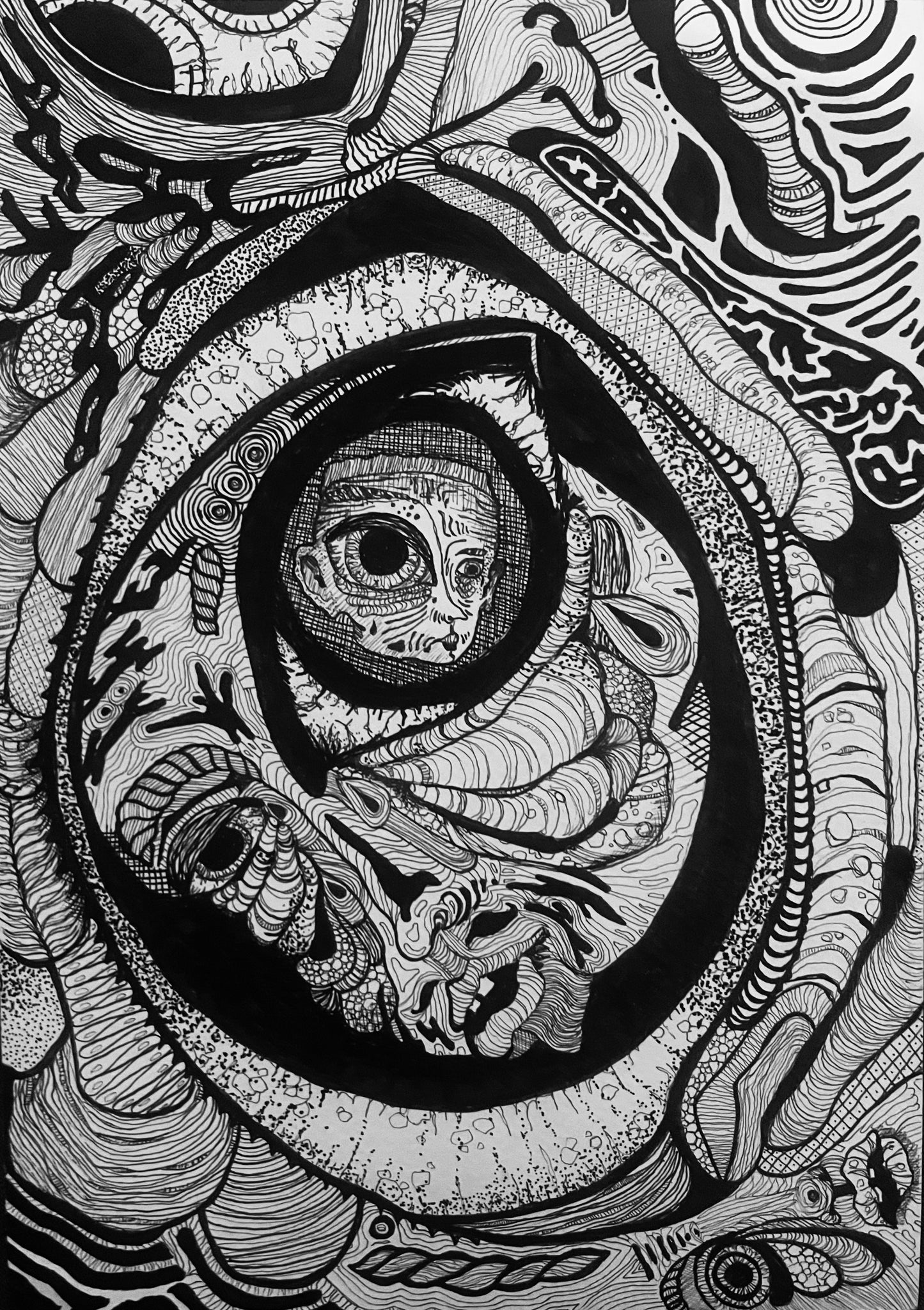 Print "Migraine"